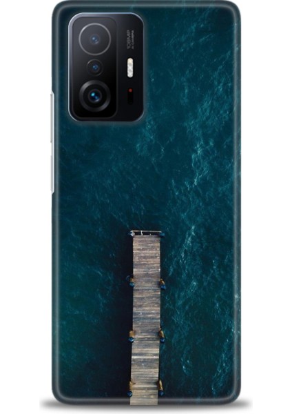 Xiaomi Mi 11T Kılıf Hd Baskılı Kılıf - Iskele