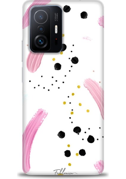 Xiaomi Mi 11T Kılıf Hd Baskılı Kılıf - Pembe ve Benekler