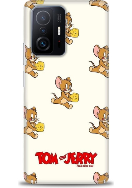 Xiaomi Mi 11T Pro Kılıf Hd Baskılı Kılıf - Jerry