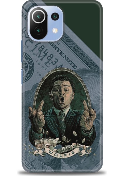 Xiaomi Mi 11 Lite Kılıf Hd Baskılı Kılıf - Dolar
