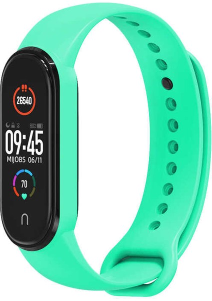 Xiaomi Mi Band 6 Uyumlu Klasik Kordon Zore - No2