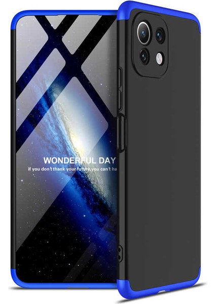 Xiaomi Mi 11 Lite Kılıf Aynalı Desenli Kamera Korumalı Parlak Miror Kapak