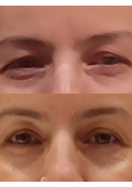 BIR'SENSE Restoratıve Ultra Mask