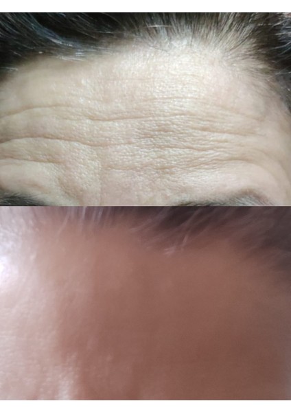 BIR'SENSE Restoratıve Ultra Mask