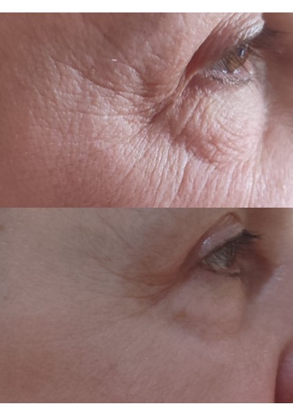 BIR'SENSE Restoratıve Ultra Mask