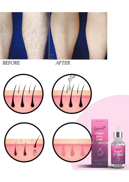 Doğal Tüy Azaltıcı Serum – Hassas Bölgeler İçin Uygun – 20 ml modelleri