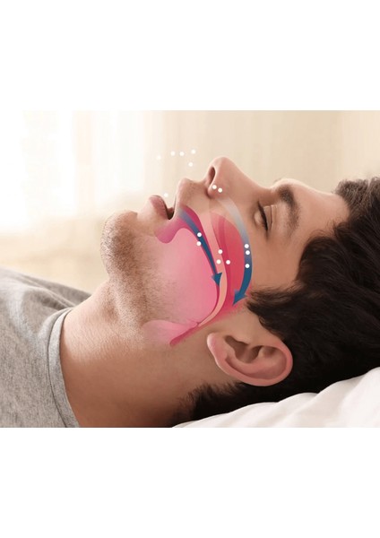 Rahat Uyku Için Anti Snore Sleep Horlama Engelleyici Aparat Uyku Stoperi ( Lisinya )