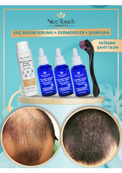 NİCE TOUCH KOZMETİK 3 Adet Saç Serum , Saç Vitamini+ 1 Adet Dermarroler+ 1 Adet Şampuan