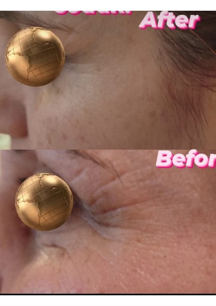 BIR'SENSE Restoratıve Ultra Mask