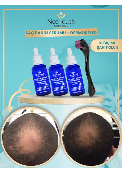 NİCE TOUCH KOZMETİK3 Adet Saç Serum , Saç Vitamini+ 1 Adet Dermarroler