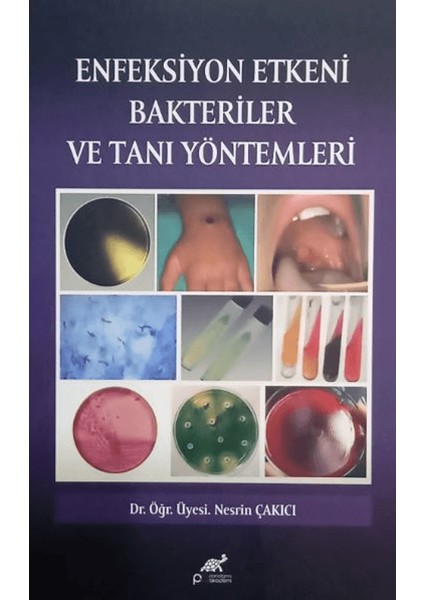 Enfeksıyon Etkeni Bakteriler ve Tanı Yöntemleri