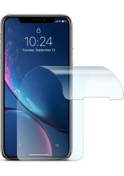 Xiaomi Redmi Note 4x Nano Micro Temperli Ekran Koruyucu