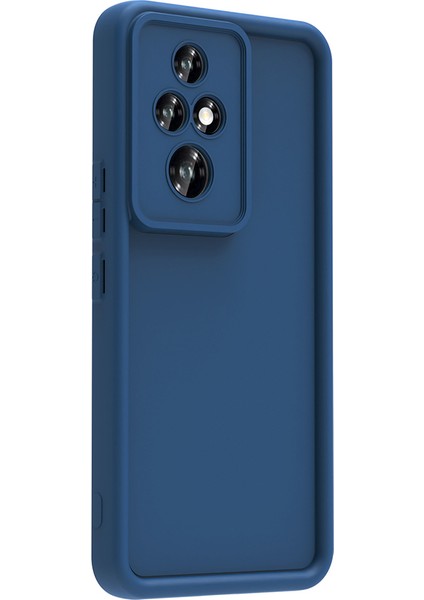 Honor 200 Uyumlu Kılıf Kamera Korumalı Kenarları Şişkin Yumuşak Şık Slikon Kapak fiyatları