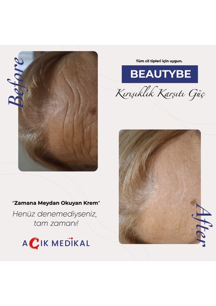 Beautybe Botoks Etkili Güç Kremi, Hyaluronik Asit, Kollajen, Peptid fiyatları