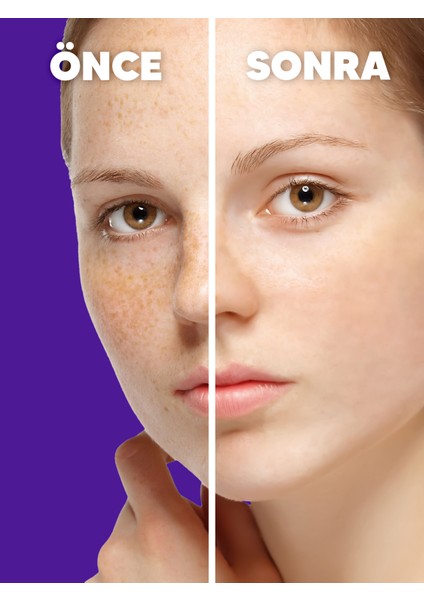 Saf Niacinamide 10 Leke Serum