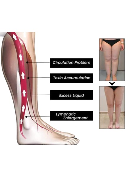 4'lü Paket Lenf Drenaj Terapisi Manyetik Halkalar, Ayarlanabilir Halka Unisex (Yurt Dışından) fırsatları