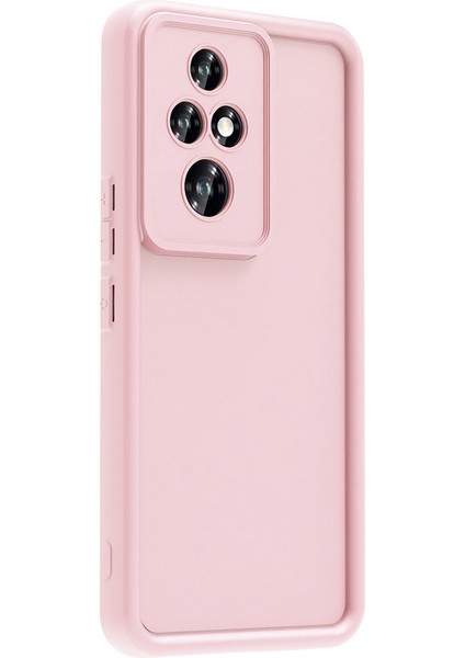 Honor 200 Pro Kılıf Kamera Korumalı Ananas Silikon Kapak