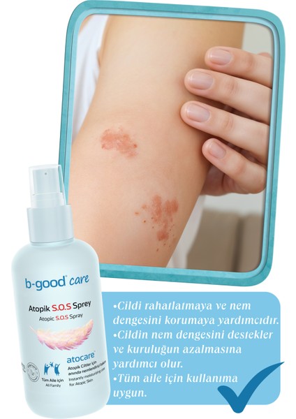 Hassas Ciltler Için Yüz & Vücut Atopik S.O.S Sprey 180 gr