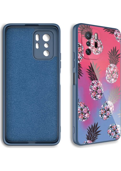 Xiaomi Redmi Note 10 Pro Kılıf Kamera Korumalı Desenli Sert Silikon Ardx Epoksi Kapak-No1