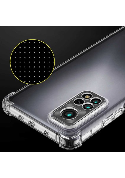Xiaomi Redmi Note 11 Global Kılıf Ardx Kamera Korumalı Nitro Anti Shock Silikon-Renksiz