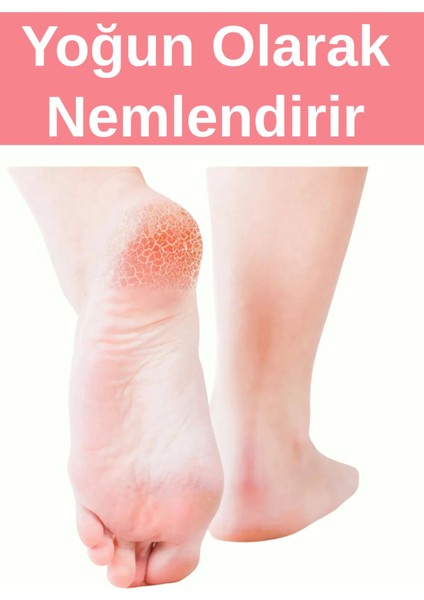 Ayak Bakım Topuk Kremi -Yoğun Onarıcı Krem fırsatları