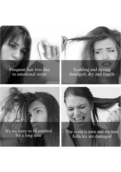 Saç Tarak Brosse Demelant Saç Fırçası Kadın Islak Kuru Tarak Saç Fırçası Saç Derisi Masaj Tarak Fırça Salon Saç Kuaförlük Araçları (Yurt Dışından) fiyatları