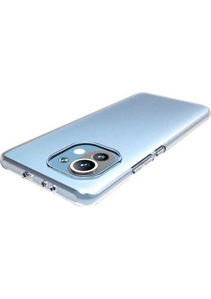 Xiaomi Mi 11 Uyumlu Kılıf Şeffaf Soft Silikon Kılıf Şeffaf