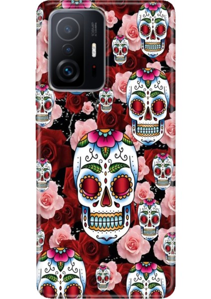 Xiaomi Mi 11T - 11T Pro Kılıf Desenli Design Silikon Kabile