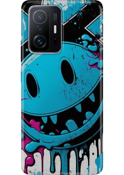Xiaomi Mi 11T - 11T Pro Kılıf Desenli Design Silikon Vintage Wall