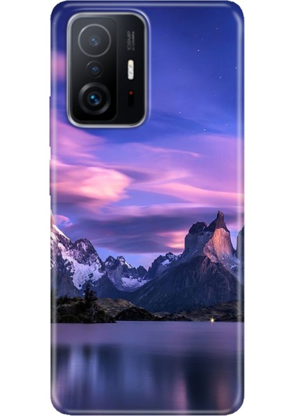 Xiaomi Mi 11T - 11T Pro Kılıf Desenli Design Silikon Kuzey