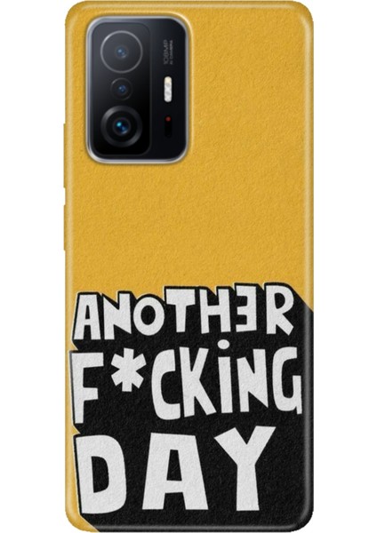 Xiaomi Mi 11T - 11T Pro Kılıf Desenli Design Silikon Another