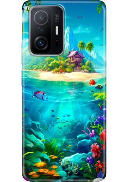 Xiaomi Mi 11T - 11T Pro Kılıf Desenli Design Silikon Island