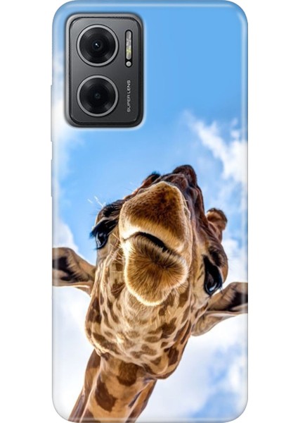 Xiaomi Redmi Note 11E Kılıf Desenli Design Silikon Öpücük