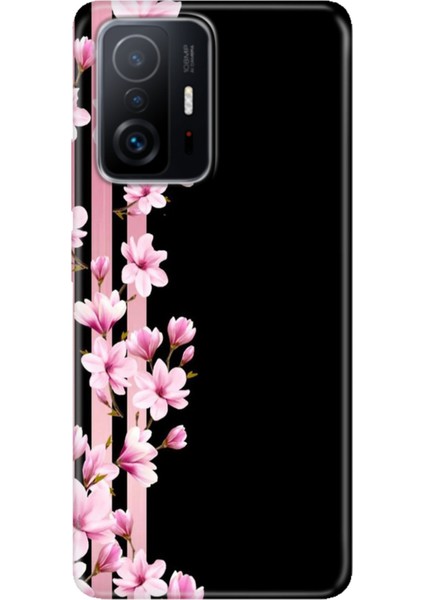 Xiaomi Mi 11T - 11T Pro Kılıf Desenli Design Silikon Natural
