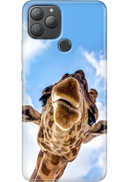 General Mobile Gm 22 Plus Kılıf Desenli Esnek Silikon Uv Öpücük