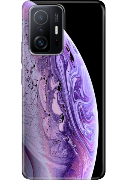 Xiaomi Mi 11T - 11T Pro Kılıf Desenli Design Silikon World