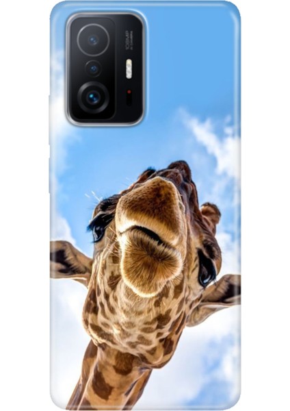 Xiaomi Mi 11T - 11T Pro Kılıf Desenli Design Silikon Öpücük