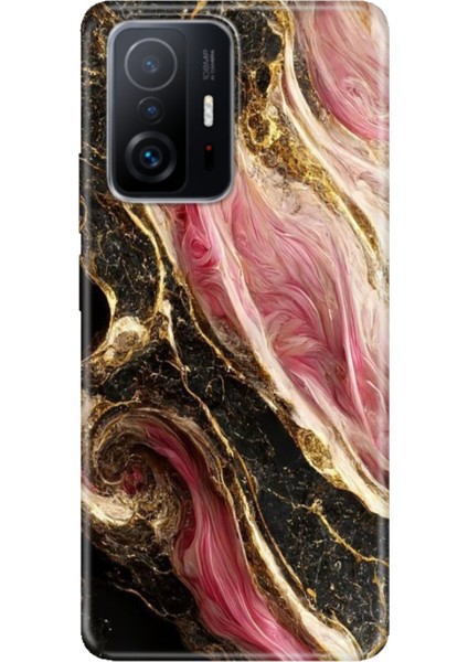 Xiaomi Mi 11T - 11T Pro Kılıf Desenli Design Silikon Seattle Mermer