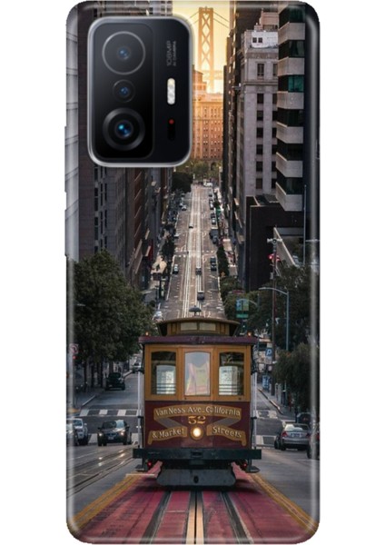 Xiaomi Mi 11T - 11T Pro Kılıf Desenli Design Silikon California
