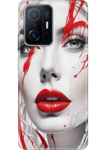 Xiaomi Mi 11T - 11T Pro Kılıf Desenli Design Silikon Lady