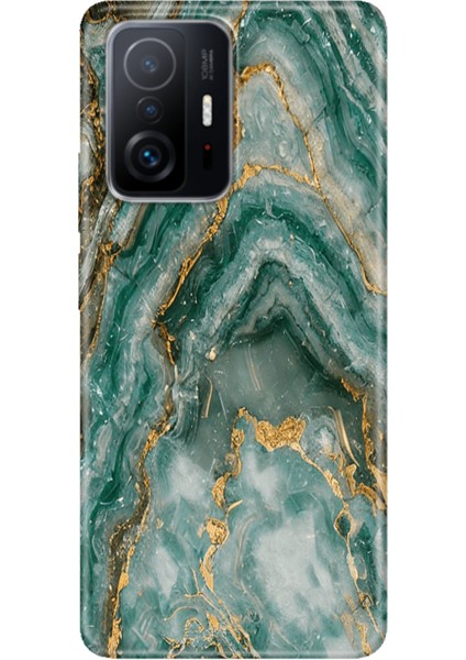 Xiaomi Mi 11T - 11T Pro Kılıf Desenli Design Silikon Granit