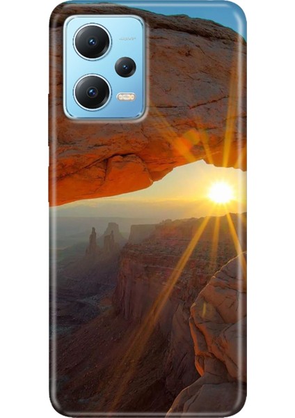 Redmi Note 12 5g Kılıf Baskılı Dokulu Kapak Silikon Sun