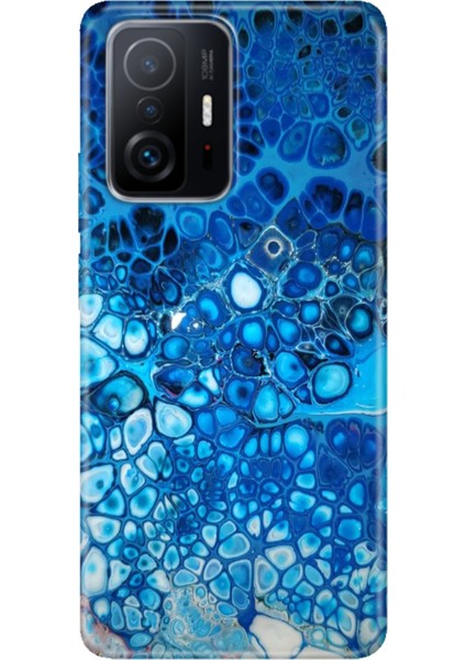 Xiaomi Mi 11T - 11T Pro Kılıf Desenli Design Silikon Derin Mavi