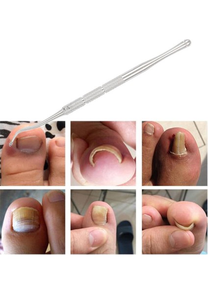 Tırnak Bakımı Kanca Dosya Temizleme Aracı 1 Takım Esnek Pedikür Araçları Batık Ayak Tırnak Düzeltme Elastik Yamalar Pedi (Yurt Dışından) fırsatları