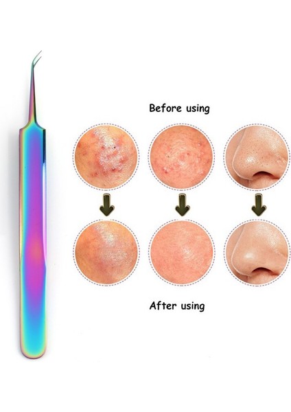 Paslanmaz Çelik Siyah Nokta Komedonlar Akne Leke Çıkarıcı Sökücü Yüz Cilt Bakımı Gözenek Temizleyici Iğneler Temizleme Araçları (Yurt Dışından) fiyatları