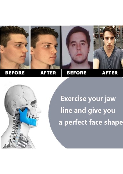 Ince Yüz Masseter Pop N Go Ağız Çene Hattı Çene Kas Egzersiz Topu Çiğneme Bite Breaker Eğitim Çene Kaldırma Masajı Cilt Bakımı (Yurt Dışından)