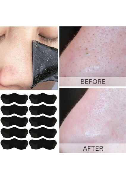 Beyaz Siyah Siyah Nokta Kaldırma Maskesi Gözenek Küçültme Burun Temizleme Çıkartmalar Kabuğu Burun Siyah Kafa Şeritleri Yüz Cilt Bakımı Maskesi Yama (Yurt Dışından) fiyatları