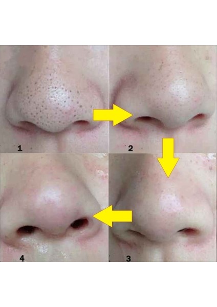 Beyaz Siyah Siyah Nokta Kaldırma Maskesi Gözenek Küçültme Burun Temizleme Çıkartmalar Kabuğu Burun Siyah Kafa Şeritleri Yüz Cilt Bakımı Maskesi Yama (Yurt Dışından) fırsatları