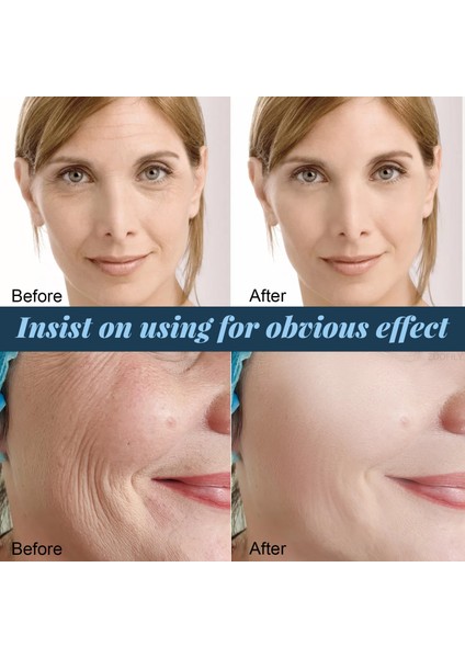 60 Adet Protein Konu Hiçbir Iğne Altın Protein Hattı Emilebilir Kollajen Yüz Germe Anti Aging Hyaluronik Sıkma Cilt Araçları (Yurt Dışından) fırsatları