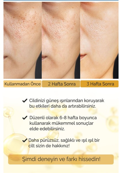 Leke Giderici Sérum BrightFix Series A200